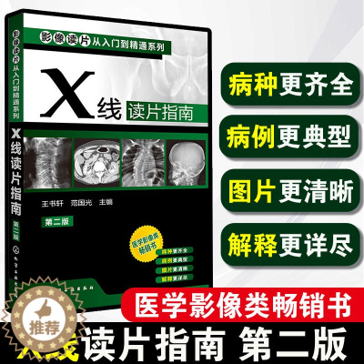 [醉染正版]正版 X线读片指南 第二版 影像读片从入门到精通系列 基层影像医生常备 影像入门读片入门 医学影像类图书