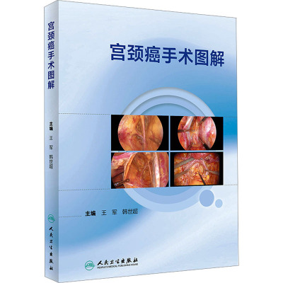宫颈癌手术图解(配增值)