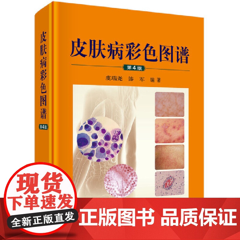 [正版书籍]皮肤病彩色图谱(第4版)