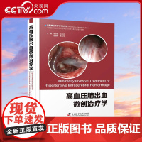 [央视网]高血压脑出血微创治疗学 从开颅手术到微创锁孔手术 从粗略定位到精确三维定位 从硬通道到软通道ZK