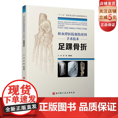 积水潭医院创伤骨科手术技术 足踝骨折 北京积水潭医院手术经验全景展示 北京科学技术