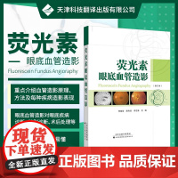 书正版]荧光素眼底血管造影 荧光造影 虹膜血管造影 血管造影对眼底病的诊断 视网膜血管性疾病 视神经疾病 葡萄膜炎眼内肿