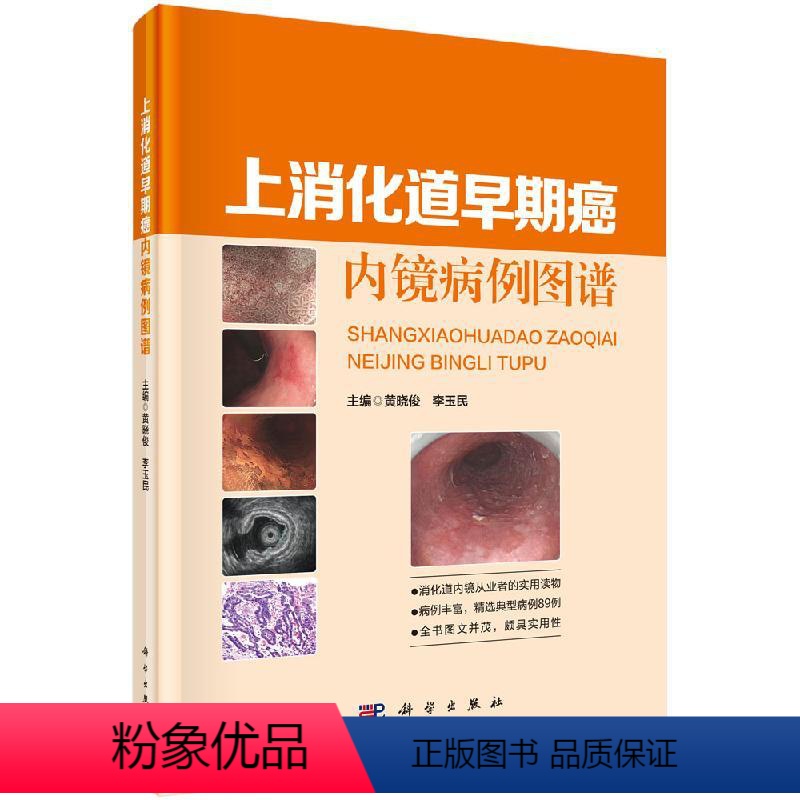 [正版]上消化道早期癌內镜病例图谱