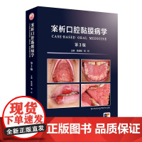 案析口腔黏膜病学(第3版)陈谦明 曾昕 人卫数字资源 人民卫生出版社9787117368889