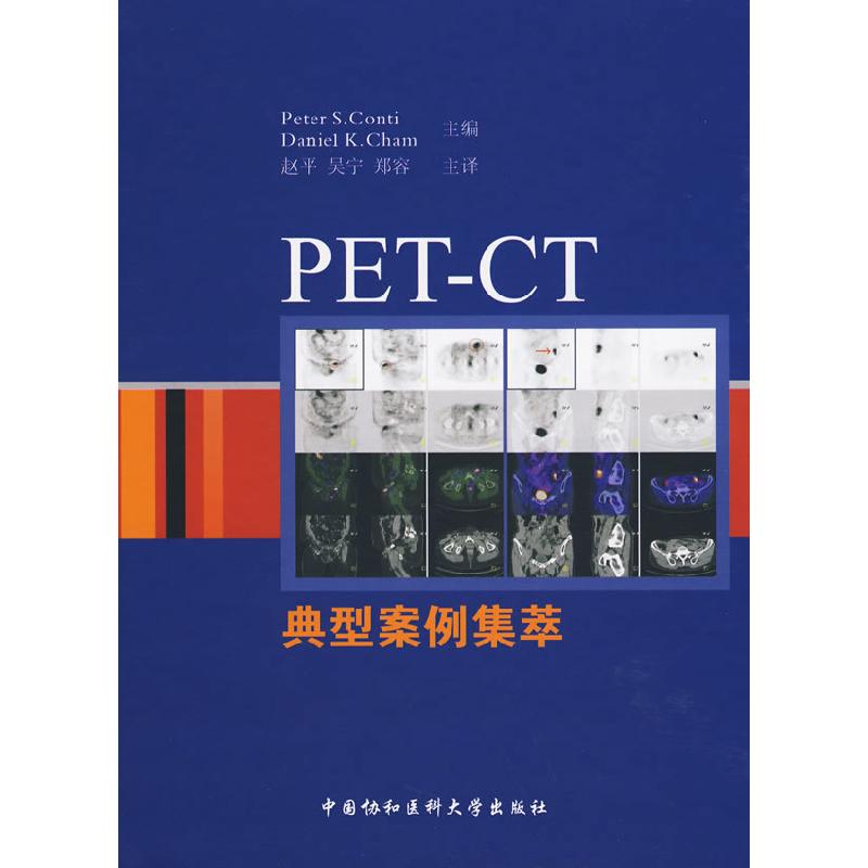 正版新书]PET-CT典型案例集萃(美)康蒂,(美)钱(Cham,D.K.) 主