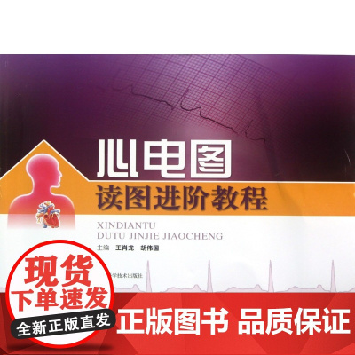 心电图读图进阶教程