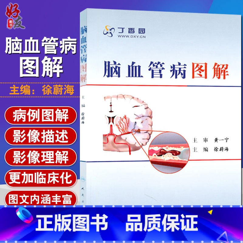 [正版] 脑血管病图解 徐蔚海主编 丁香园医学参考书籍 脑血管治疗学医学工具书籍 脑血管病基础知识 临床经验97871