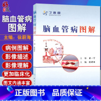 [正版] 脑血管病图解 徐蔚海主编 丁香园医学参考书籍 脑血管治疗学医学工具书籍 脑血管病基础知识 临床经验97871