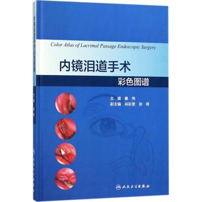 内镜泪道手术彩色图谱
