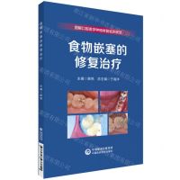 [N]食物嵌塞的修复治疗/图解口腔美学种植修复临床规范-9787521437690