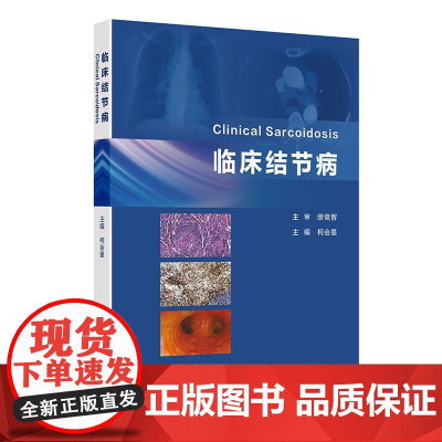 临床结节病 2024年12月参考书