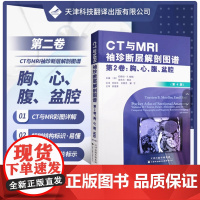 书]CT与MRI袖珍断层解剖图谱第2卷:胸、心、腹、盆、腔 引进版 影像医学 人体解剖图谱彩色图谱 影像断层解剖实用图谱