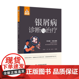 银屑病诊断与治疗(健康中国·家有名医丛书)