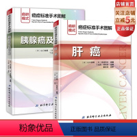 [正版]癌症标准手术图解肝癌+胰腺癌及胆管癌全2册套装 平装 山口俊晴斋浦明夫著丁光辉项灿宏主译北京科学技术出版社