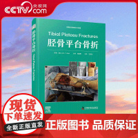 [央视网]胫骨平台骨折 Tibial Plateau Fractures 一部关于胫骨平台骨折的专业著作 ZK
