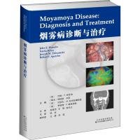 烟雾病诊断与治疗