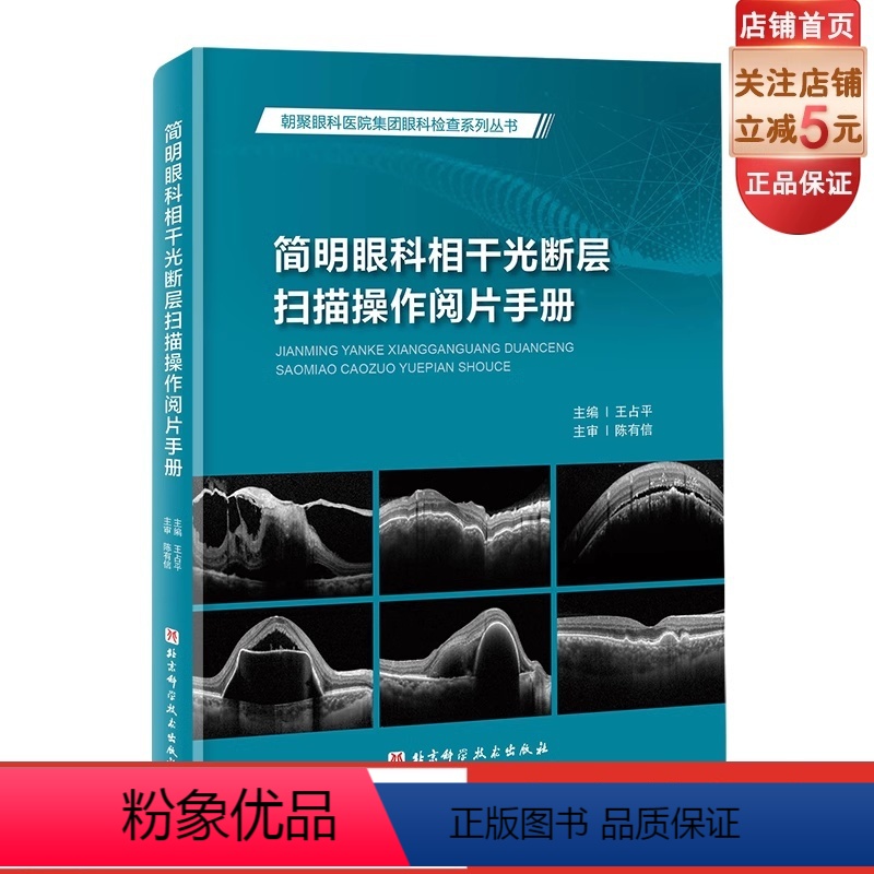 [正版]简明眼科相干光断层扫描操作阅片手册 图文并茂 病例分析 北京科学技术