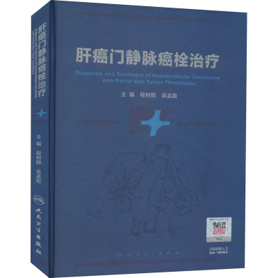 肝癌门静脉癌栓治疗