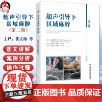 超声引导下区域麻醉 第2二版 张庆梅 夏晓琼 余泳波 主译 日常工作的实践指南 涵盖最常见的阻滞和手术过程 科学技术文献