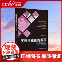 [央视网]皮肤黑素细胞肿瘤病理图谱 常建民 国内皮肤黑素细胞肿瘤的病理图谱 ZK