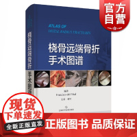 桡骨远端骨折手术图谱 700余幅图解 骨科临床参考工具书 关节镜技术 中尺/桡骨远端各种可能的骨折 医学工具书 上海科学