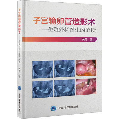 醉染图书子宫输卵管造影术——生殖外科医生的解读9787565925917