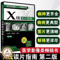 [醉染正版]正版 X线读片指南 第二版 影像读片从入门到精通系列 基层影像医生常备 影像入门读片入门 医学影像类图书