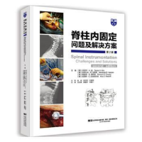 醉染图书脊柱内固定 问题及解决方案 第2版9787559115492