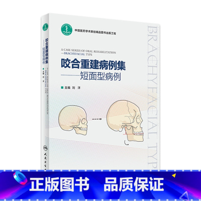 [正版]咬合重建病例集——短面型病例 2023年1月参考书 9787117337946