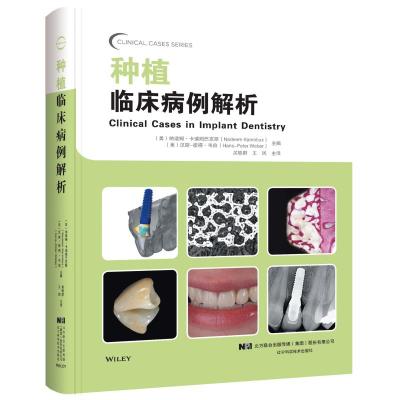 种植临床病例解析