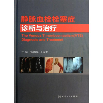 [M]静脉血栓栓塞症诊断与治疗-9787117180627