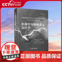 [央视网]影像引导肿瘤介入治疗学 肿瘤微创介入治疗技术的新进展 肿瘤介入治疗相关免疫调节 肿瘤介入治疗医学书 ZK