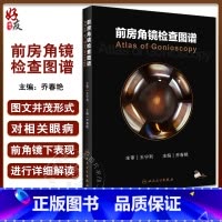 [正版]前房角镜检查图谱 乔春艳 眼科基本检查 疾病特征 青光眼激光手术治疗应用 眼科医生参考工具书 人民卫生出版社9