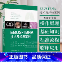 EBUSTBNA技术及经典案例 [正版]EBUSTBNA技术及经典案例 超声内镜引导下经支气管针吸活检术 李时悦主编 上