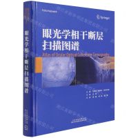 [N]眼光学相干断层扫描图谱(精)-9787543340664