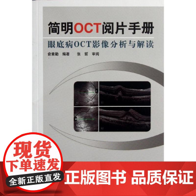 简明OCT阅片手册 眼底病眼科OCT影像分析与解读 俞素勤编著 基础阅片影像眼科学视光技术应用 人民卫生出版社97871