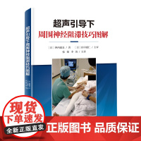 超声引导下周围神经阻滞技巧图解 影响医学 现代医学 北京科学技术