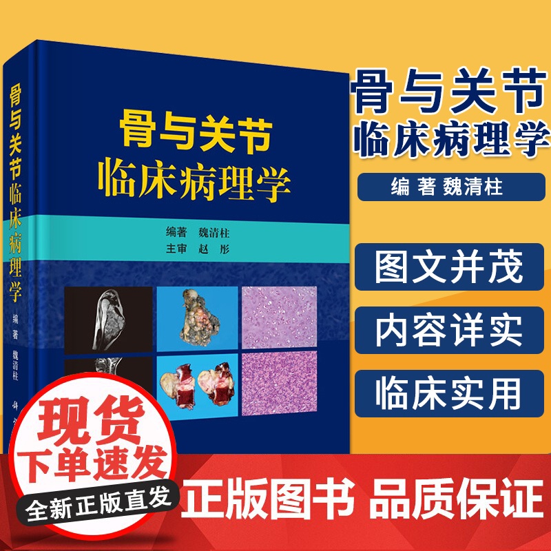 正版 骨与关节临床病理学 骨与关节肿瘤及瘤样病变的临床 影像和病理特点 魏清柱 编著 科学出版社9787030608