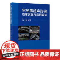 罕见病超声影像临床实践与病例解析 王淑敏 崔立刚 北京大学医学出版社9787565932694罕见病临床诊断治疗
