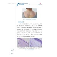 首都医科大学附属北京佑安医院皮肤性病病例精解